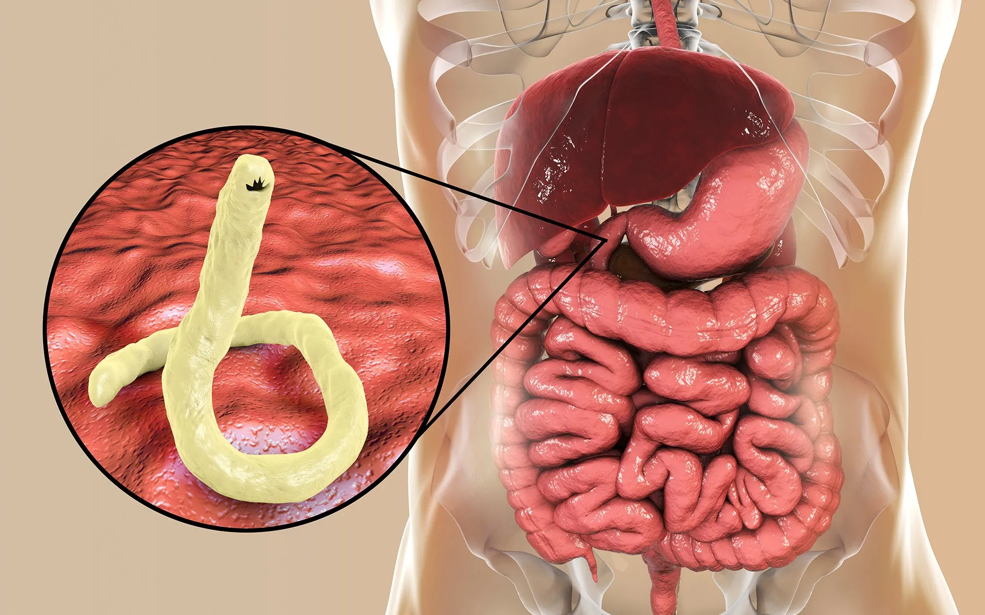 Vermixin 🔺 gyógyszertár, ár, vélemények, fórum, hatás, átverés?